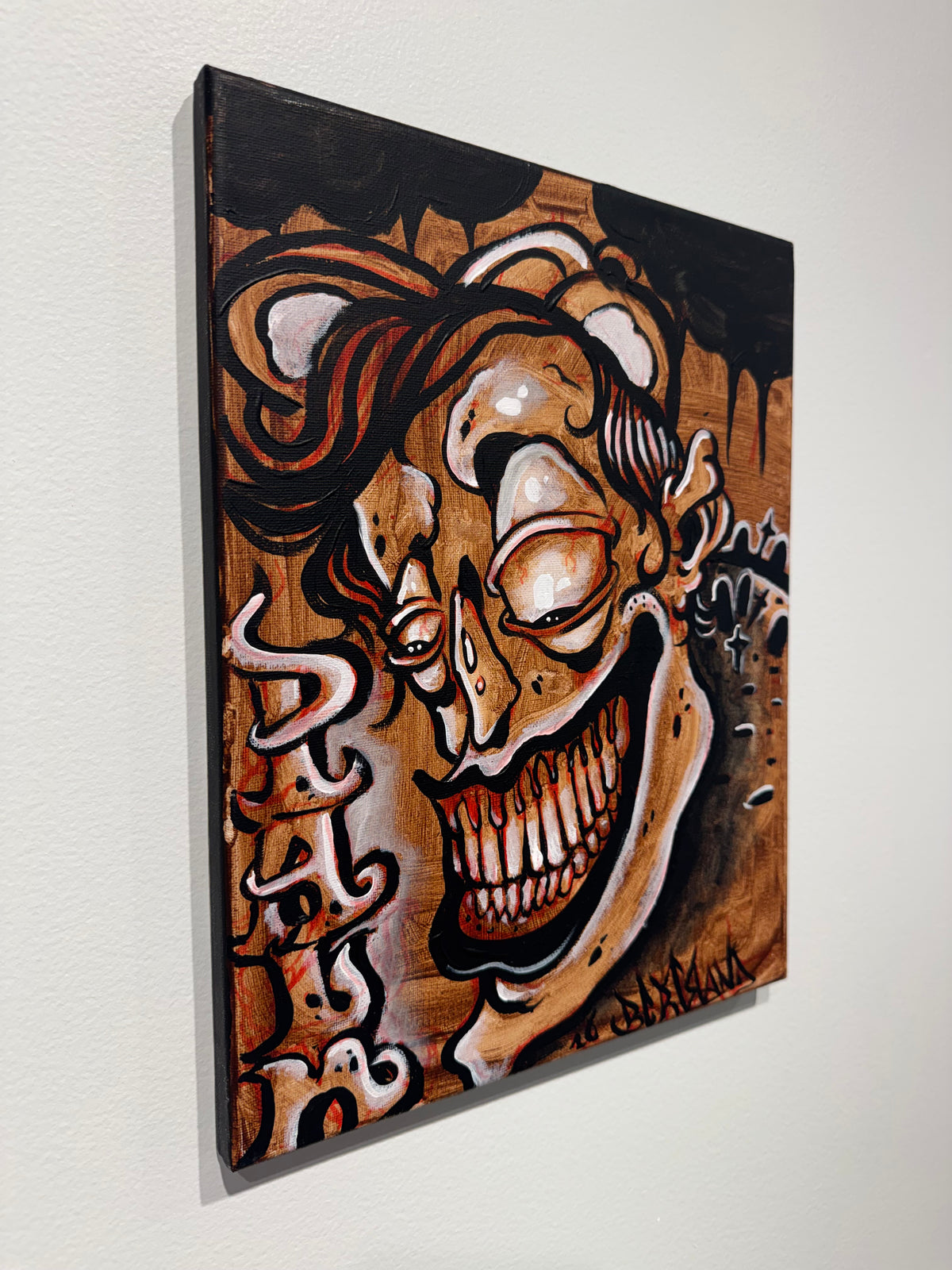 Pain
